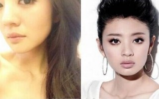 为什么眼睛边上很厚，为什么眼睛边上很厚的皮